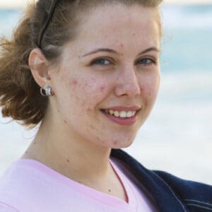 get rid of acne naturally